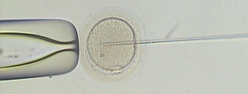 Male Fertility and ICSI