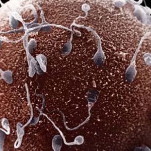 sperm count