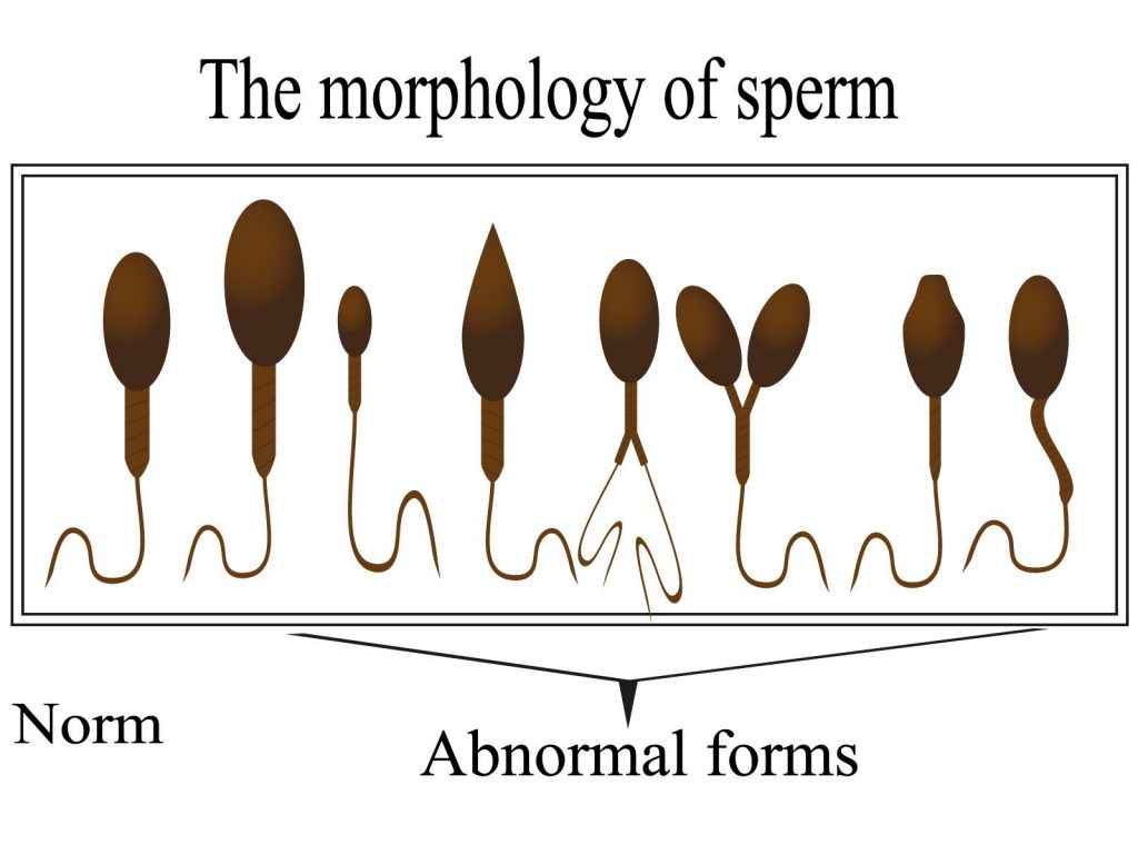 poor-sperm-morphology