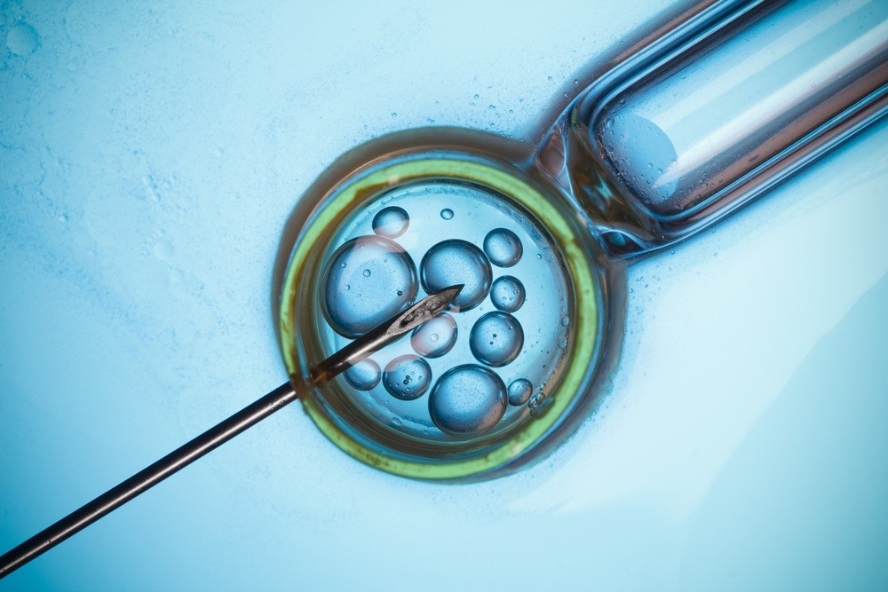 IVF in London