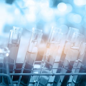 test tubes