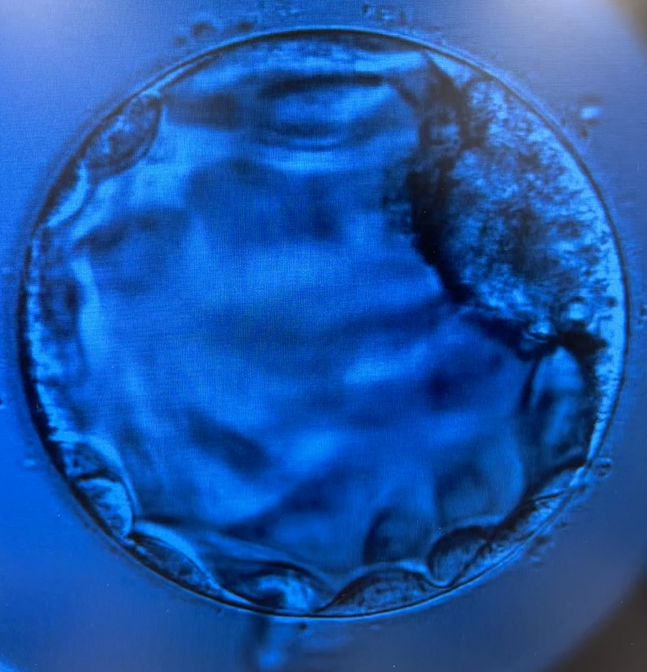 Embryo