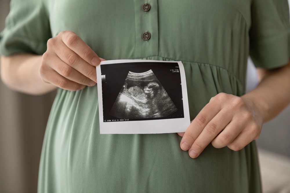 pregnant woman holding a scan photo in front of her belly